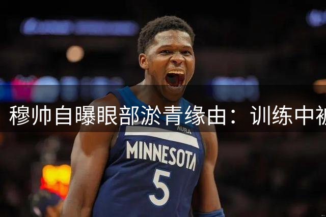 穆帅自曝眼部淤青缘由：训练中被青训小将误伤